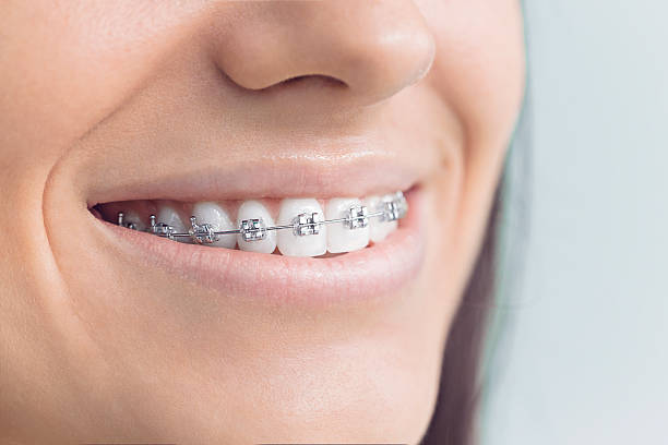 Best Dental Inlays and Onlays  in Exander City, AL